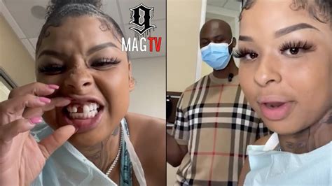 chrisean rock missing teeth|(Video) Chrisean Rock Shares Shes Getting Her Missing Tooth。